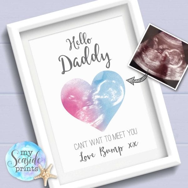 Baby scan personalised print for Daddy from bump