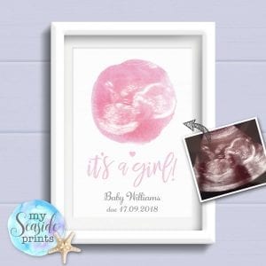 Personalised Baby Scan Print - it's a girl!