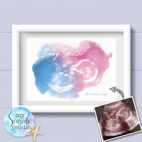 Baby scan personalised print for baby shower